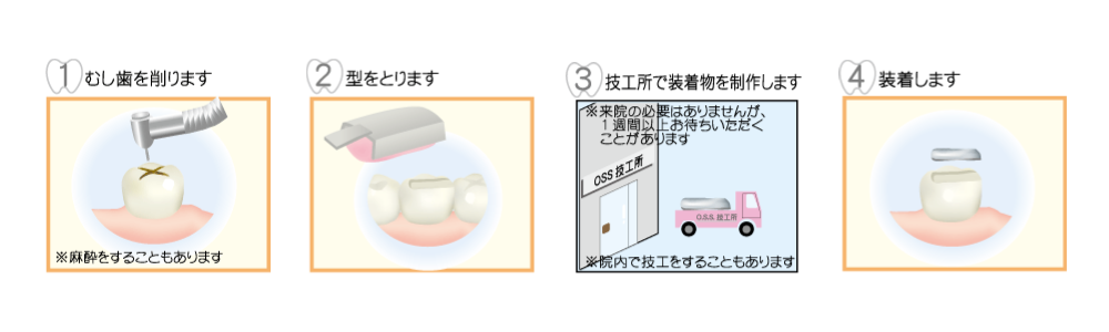 つめものの写真(山口県萩市)