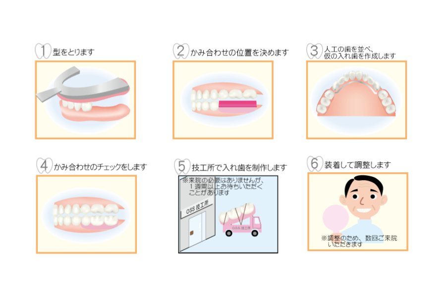入れ歯の写真(山口県萩市)